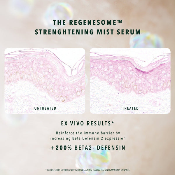 REGENESOME™ PROCEDURE PREP KIT